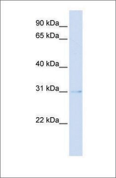 Anti-PVRIG antibody produced in rabbit affinity isolated antibody