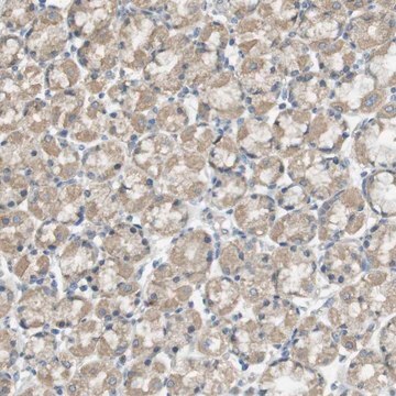 Anti-ZDHHC20 antibody produced in rabbit Prestige Antibodies&#174; Powered by Atlas Antibodies, affinity isolated antibody, buffered aqueous glycerol solution