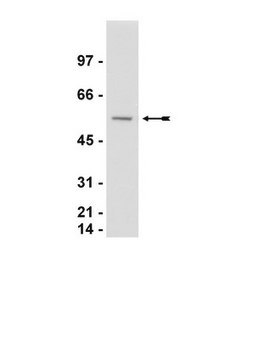 Anti-Calreticulin Antibody Upstate&#174;, from rabbit