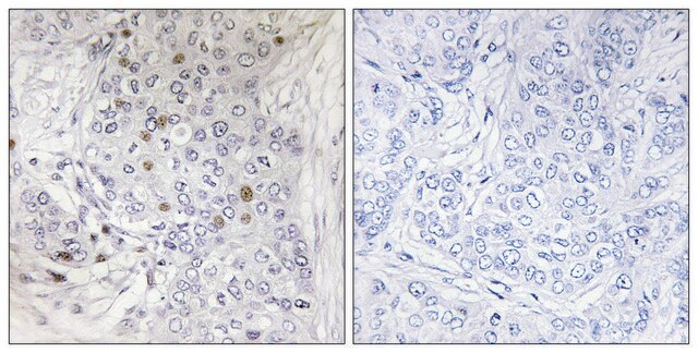 Anti-MAFF antibody produced in rabbit affinity isolated antibody