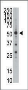 Anti-HtrA1 (N-term) antibody produced in rabbit IgG fraction of antiserum, buffered aqueous solution