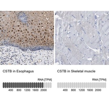 Anti-CSTB antibody produced in rabbit Prestige Antibodies&#174; Powered by Atlas Antibodies, affinity isolated antibody, buffered aqueous glycerol solution