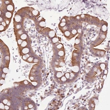 Anti-NMRK1 antibody produced in rabbit Prestige Antibodies&#174; Powered by Atlas Antibodies, affinity isolated antibody, buffered aqueous glycerol solution