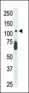 ANTI-CDKL5 (STK9)(C-TERMINAL) antibody produced in rabbit IgG fraction of antiserum, buffered aqueous solution