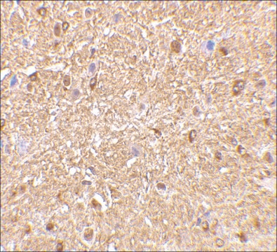 Anti-NOGOA (ab1) antibody produced in rabbit affinity isolated antibody, buffered aqueous solution