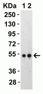 Anti-SARS-CoV-2 (COVID-19) Nucleocapsid antibody produced in rabbit affinity isolated antibody