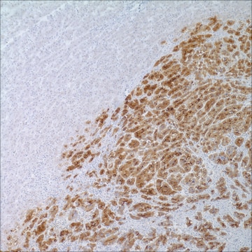 Glypican-3 (1G12) Mouse Monoclonal Antibody