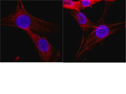 Anti-Histone Antibody, clone H11-4 clone H11-4, Chemicon&#174;, from mouse