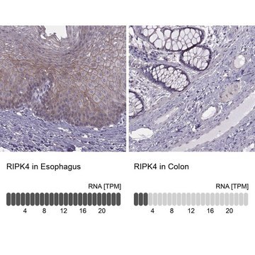 Anti-RIPK4 Prestige Antibodies&#174; Powered by Atlas Antibodies, affinity isolated antibody