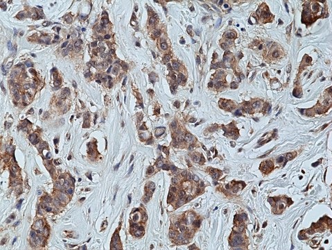 Anti-p70S6K Rabbit Monoclonal Antibody clone RM438, affinity purified immunoglobulin