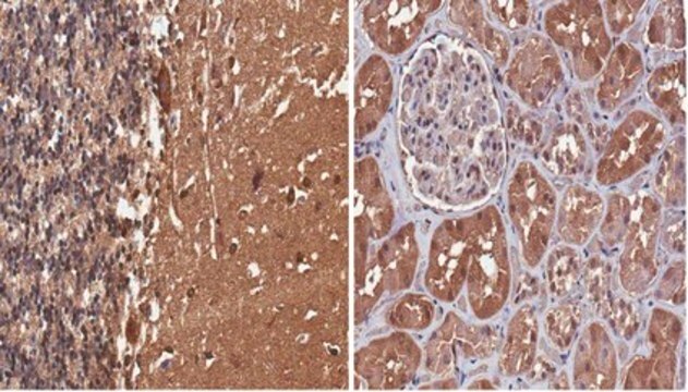 Anti-Tau (4-repeat isoform RD4) Antibody, clone 7D12.1 clone 7D12.1, from mouse