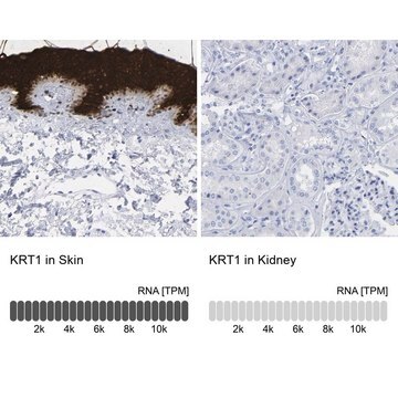 Anti-KRT1 antibody produced in rabbit Prestige Antibodies&#174; Powered by Atlas Antibodies, affinity isolated antibody, buffered aqueous glycerol solution