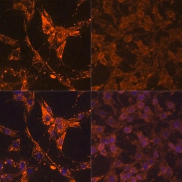 Anti-Pan Phospho-Tyrosine antibody produced in rabbit