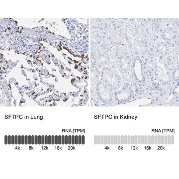 Anti-SFTPC antibody produced in rabbit Prestige Antibodies&#174; Powered by Atlas Antibodies, affinity isolated antibody, buffered aqueous glycerol solution, Ab1