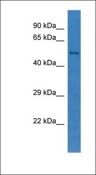 Anti-CCBE1 antibody produced in rabbit affinity isolated antibody