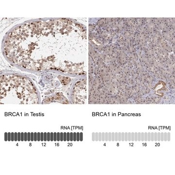 Anti-BRCA1 Prestige Antibodies&#174; Powered by Atlas Antibodies, affinity isolated antibody