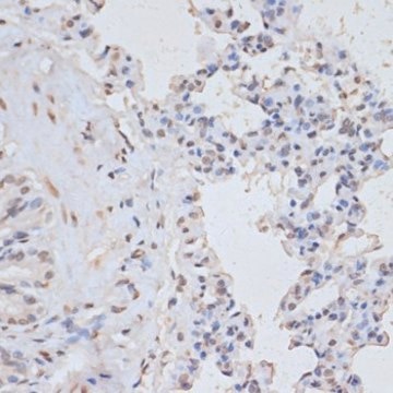 Anti-Phospho-MAPK3-Y204 antibody produced in rabbit