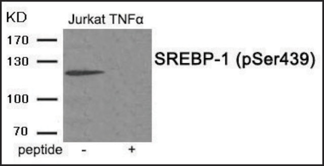 Anti-phospho-SREBP-1 (pSer439) antibody produced in rabbit affinity isolated antibody