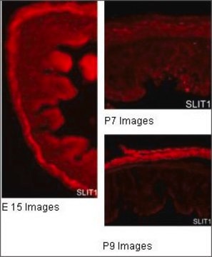 Anti-SLIT1 antibody produced in rabbit affinity isolated antibody