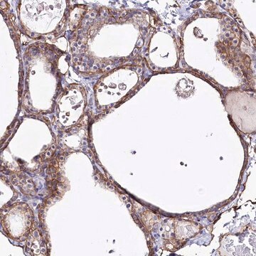 Anti-SLC39A10 antibody produced in rabbit Prestige Antibodies&#174; Powered by Atlas Antibodies, affinity isolated antibody, buffered aqueous glycerol solution