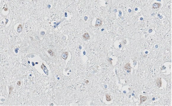 Anti-APP Antibody, clone 1F22 ZooMAb&#174; Rabbit Monoclonal recombinant, expressed in HEK 293 cells