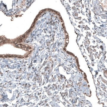 Anti-NUDT16L1 antibody produced in rabbit Prestige Antibodies&#174; Powered by Atlas Antibodies, affinity isolated antibody, buffered aqueous glycerol solution