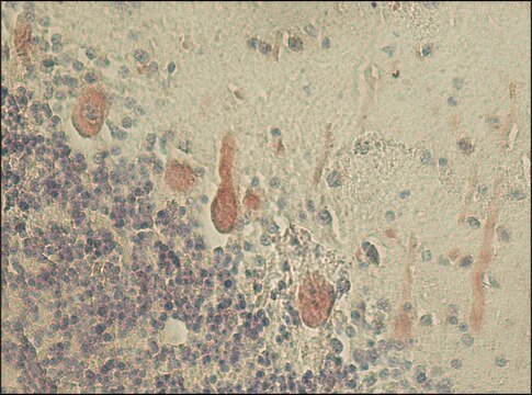 Anti-Neurofilament 200 (Phos and Non-Phos) antibody, Mouse monoclonal clone N52, purified from hybridoma cell culture