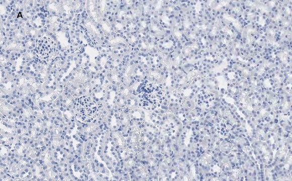 Anti-Calbindin D-28K clone 1A11 Antibody, ZooMAb&#174; Rabbit Monoclonal recombinant, expressed in HEK 293 cells