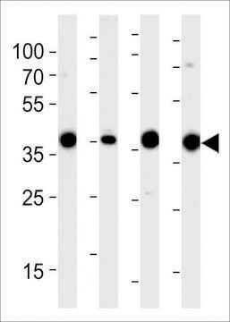 ANTI-ALDOLASE (ALDOA)(N-TERMINAL) antibody produced in rabbit purified immunoglobulin, buffered aqueous solution