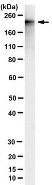 Anti-Adenylate Cyclase Toxin Antibody, B. pertussis Antibody, clone 9D4 clone 9D4, from mouse