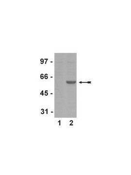 Anti-phospho-Smad2 (Ser465/467) Antibody, clone A5S, rabbit monoclonal culture supernatant, clone A5S, Upstate&#174;