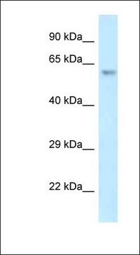 Anti-ERG antibody produced in rabbit affinity isolated antibody