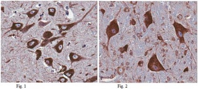 Anti-MANF Antibody from rabbit, purified by affinity chromatography