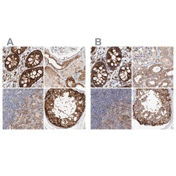 Anti-CARMIL1 antibody produced in rabbit Prestige Antibodies&#174; Powered by Atlas Antibodies, affinity isolated antibody, buffered aqueous glycerol solution, ab2