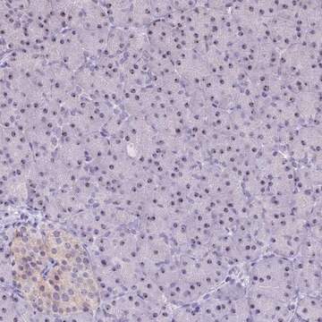 Anti-CMSS1 antibody produced in rabbit Prestige Antibodies&#174; Powered by Atlas Antibodies, affinity isolated antibody, buffered aqueous glycerol solution