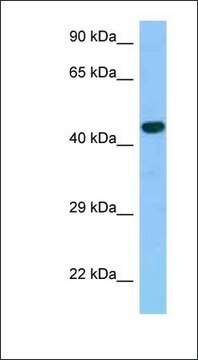 Anti-GPER antibody produced in rabbit affinity isolated antibody