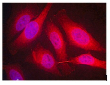 Anti-Spred-1 Antibody, clone M23-P2G3 clone M23-P2G3, from mouse, purified by affinity chromatography