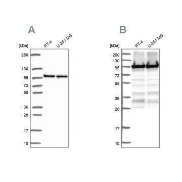 Anti-EEF2 antibody produced in rabbit Prestige Antibodies&#174; Powered by Atlas Antibodies, affinity isolated antibody