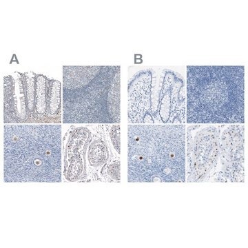 Anti-SALL4 antibody produced in rabbit Prestige Antibodies&#174; Powered by Atlas Antibodies, affinity isolated antibody, buffered aqueous glycerol solution