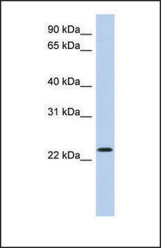 Anti-ATF3 antibody produced in rabbit affinity isolated antibody