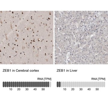 Anti-ZEB1 antibody produced in rabbit Prestige Antibodies&#174; Powered by Atlas Antibodies, affinity isolated antibody, buffered aqueous glycerol solution