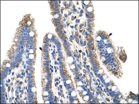 Anti-SLC25A39 antibody produced in rabbit affinity isolated antibody