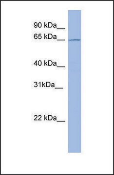 Anti-METTL3 antibody produced in rabbit affinity isolated antibody