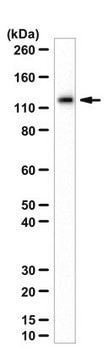 Anti-Beta Galactosidase Antibody, E. coli from chicken, purified by affinity chromatography