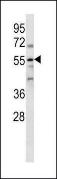 ANTI-PARP2 (N-TERM) antibody produced in rabbit IgG fraction of antiserum, buffered aqueous solution