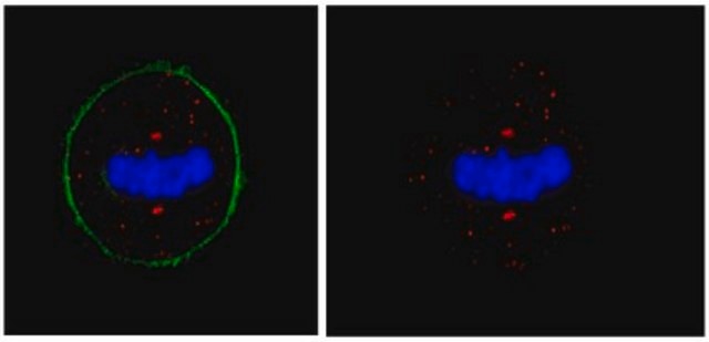 Anti-Pericentrin Antibody from rabbit, purified by affinity chromatography