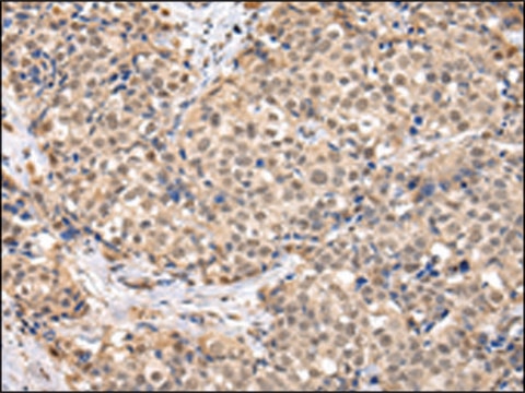 Anti-TBL1X affinity isolated antibody