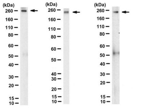 Anti-ApoB Antibody, clone 2G11 clone 2G11, from mouse