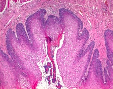 Phloxin B (C.I. 45410) for microscopy Certistain&#174;