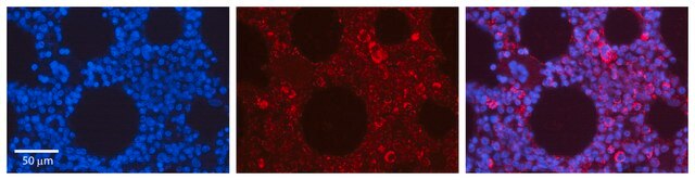 Anti-EPOR antibody produced in rabbit affinity isolated antibody